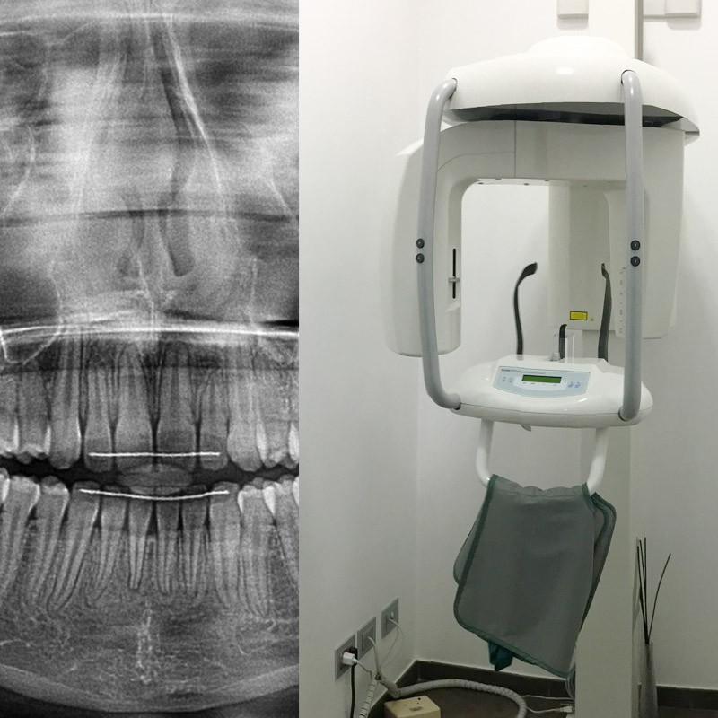 Radiologia Digitale - OPT
