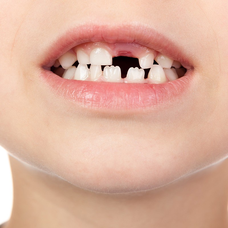 Odontoiatria Pediatrica